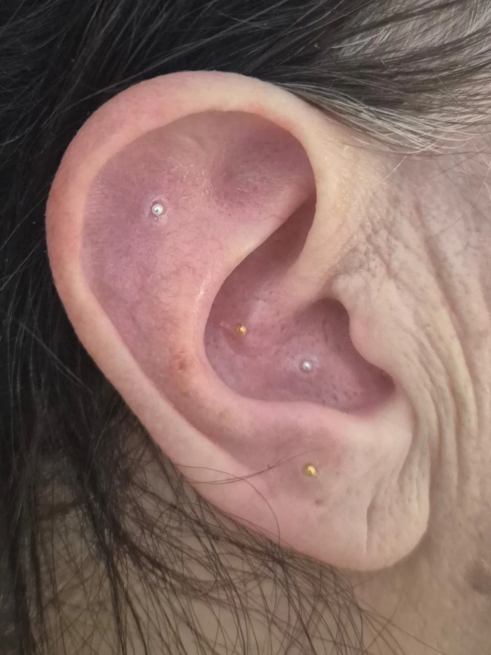 Close-up of Maxine’s ear-seeding placement, example 2