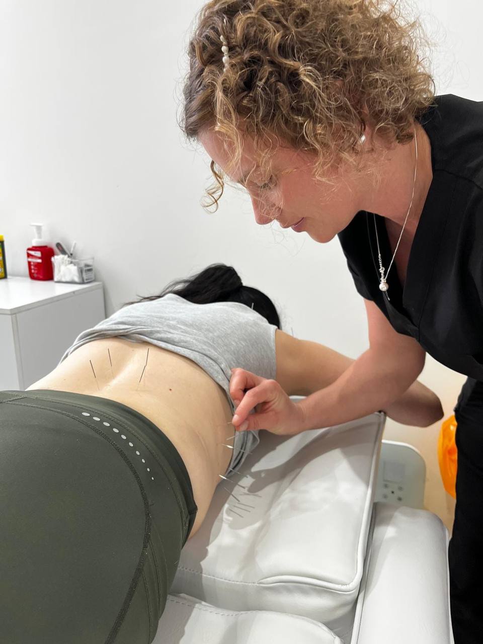 Acupuncture needles placed during a lower back treatment